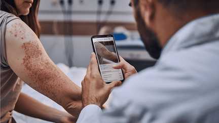 Un avis en quelques secondes à partir d'une simple photo : une start-up espagnole utilise l'IA pour diagnostiquer les affections cutanées