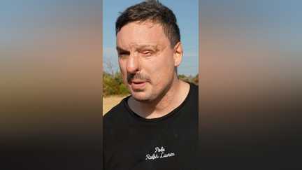 Un pompier gravement brûlé continue son combat