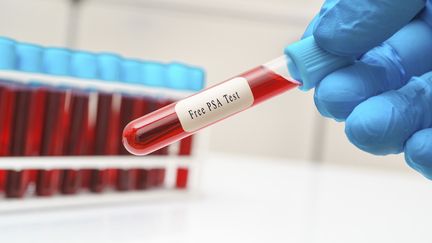 Cancer de la prostate : un nouveau traitement permet de prolonger de deux ans la survie des patients présentant des métastases, selon une étude